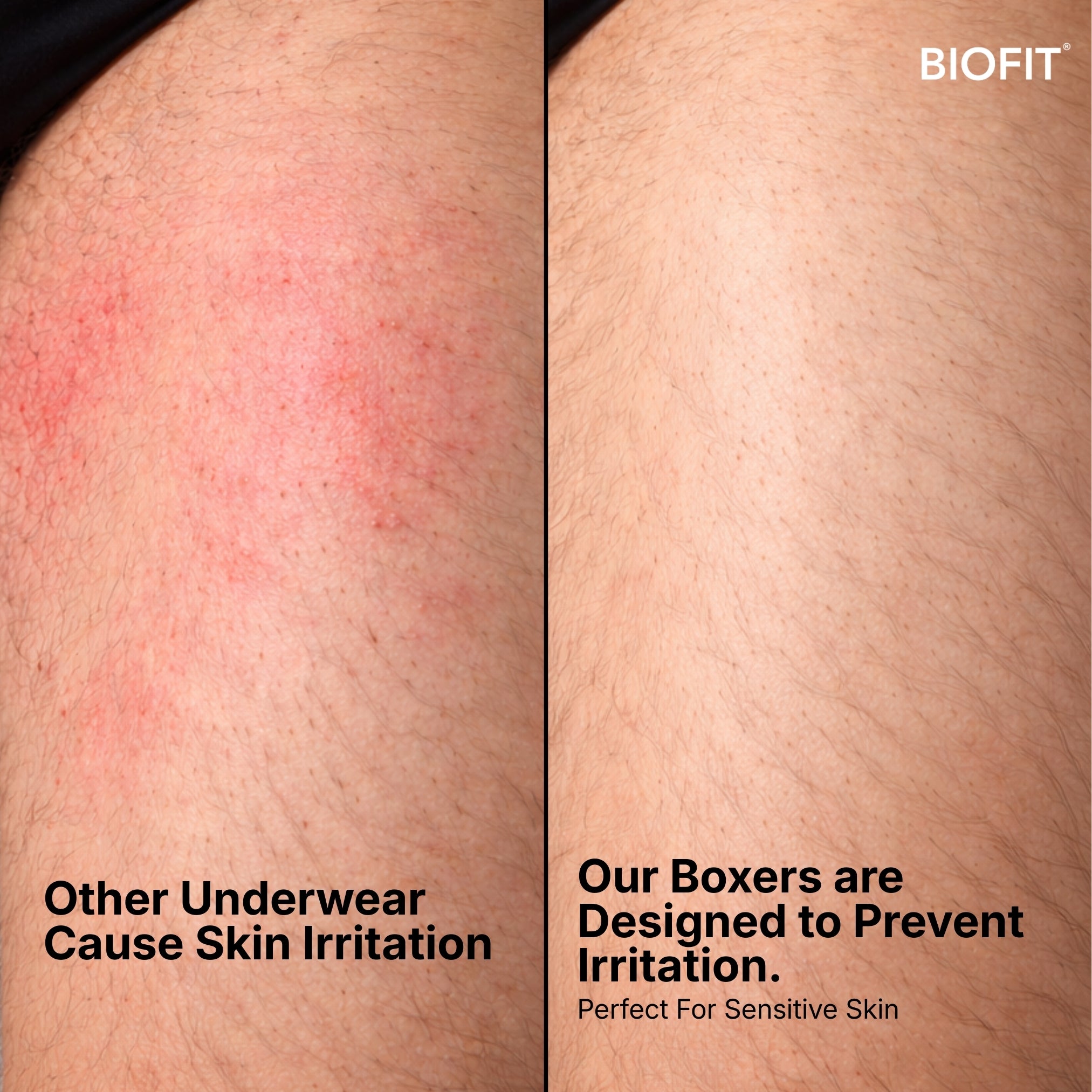 BIOFIT Essentials Boxers 5-Pack Black | + 5 FREE